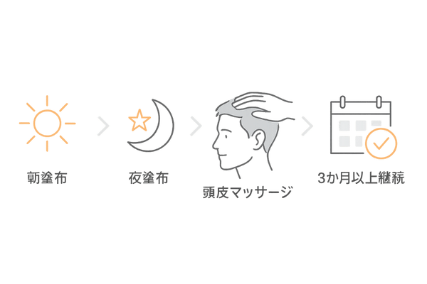 ミノキシジル5%の正しい使い方フローチャート