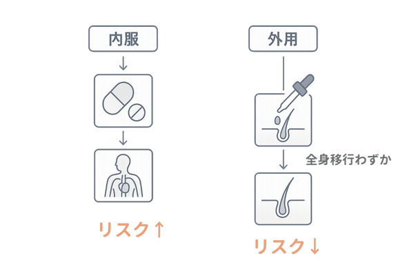 ミノキシジル内服と外用の作用の違いと多毛症リスク比較フロー