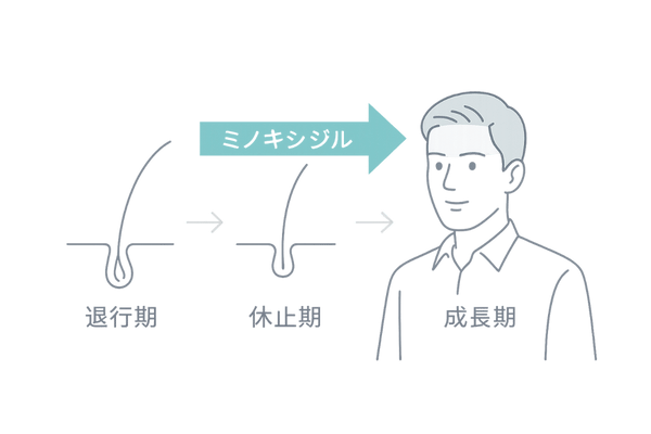 ミノキシジルで正常化するヘアサイクルフロー