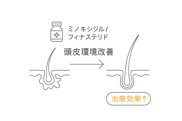 頭皮環境改善でAGA治療効果アップ