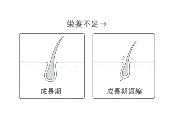 髪の成長サイクルと栄養不足の影響を示すイラスト