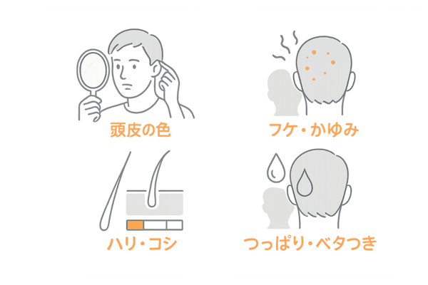 頭皮セルフチェック4ポイント図