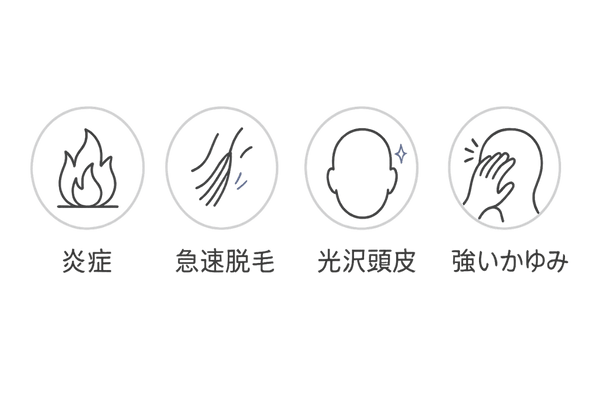 専門医受診の目安となる4つの頭皮サイン
