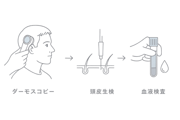ダーモスコピー・頭皮生検・血液検査の流れを示す検査プロセス図