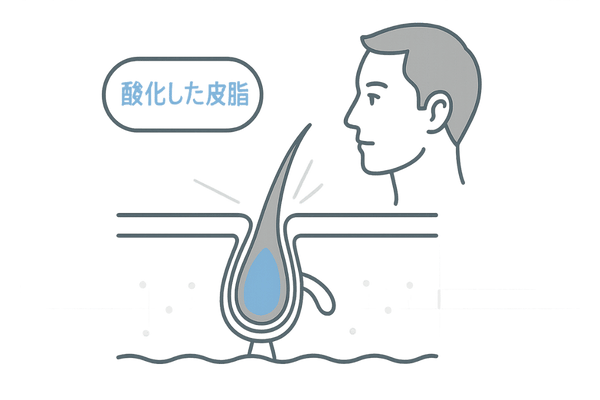 皮脂の酸化と毛穴詰まりの仕組み図