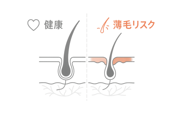 頭皮環境の変化と薄毛リスク(健康頭皮 vs 脂漏性皮膚炎)