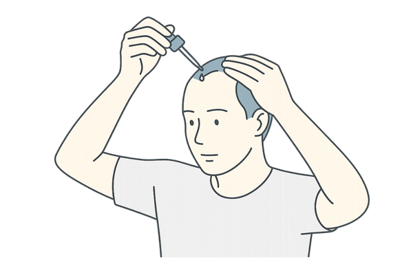 外用薬で頭皮に直接アプローチする男性のイラスト