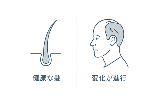 40代男性の髪と頭皮の変化をビジュアルで解説