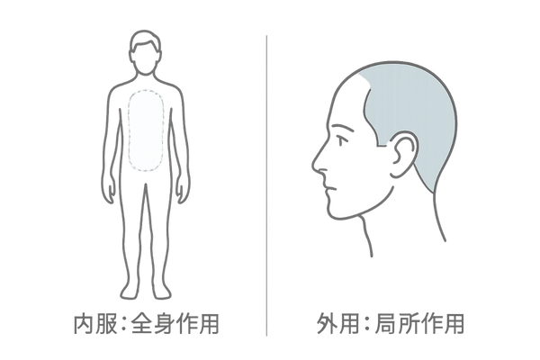 内服と外用スピロノラクトンの作用範囲を比較するイメージ