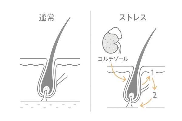 コルチゾールが毛周期に与える影響|成長期短縮と休止期移行のメカニズム図
