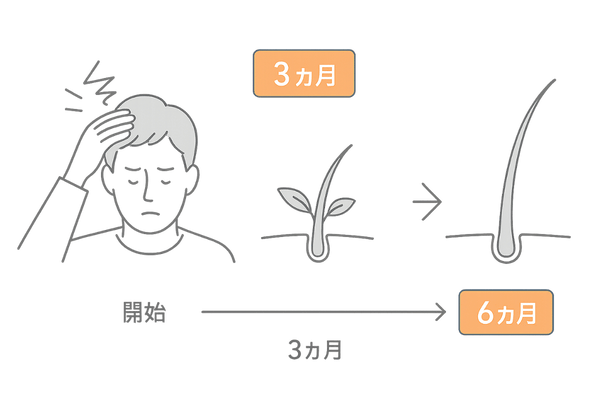 ストレス性脱毛回復までのヘアサイクルタイムライン
