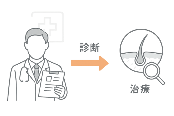 ストレス性脱毛の医療機関治療イメージイラスト