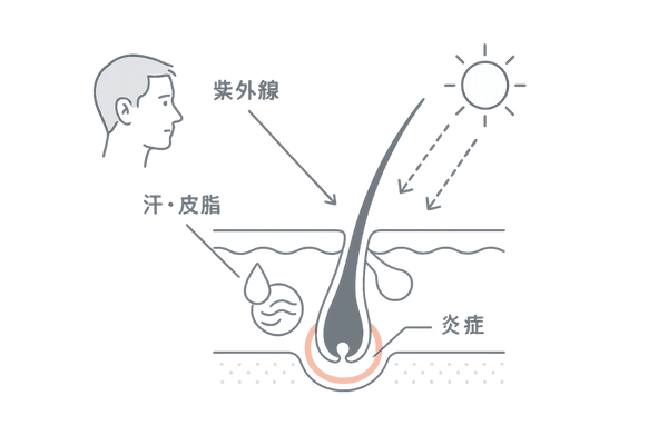 夏の抜け毛の原因イメージ｜紫外線・汗・皮脂が頭皮環境へ与える影響（断面図）