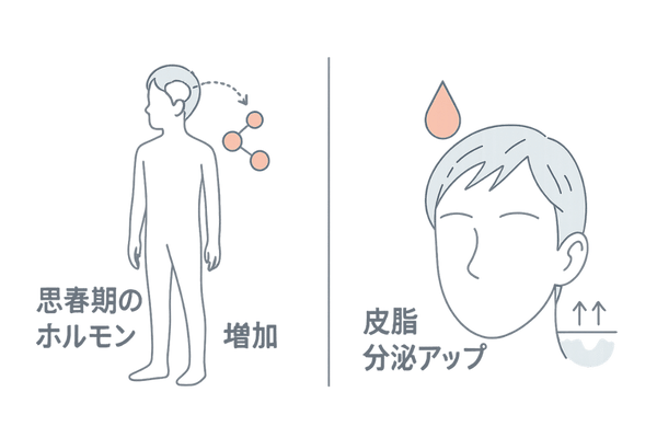 思春期ホルモン変化と頭皮への影響のイメージ図