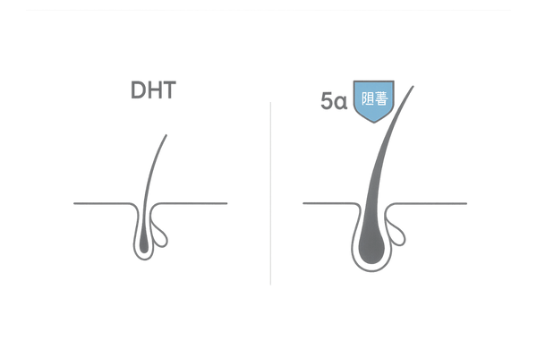 DHTと5αリダクターゼ阻害が毛包に与える影響の比較(頭皮断面図)