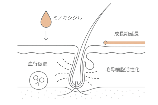 ミノキシジル外用薬の作用機序図解｜血行促進・毛母細胞活性化・成長期延長