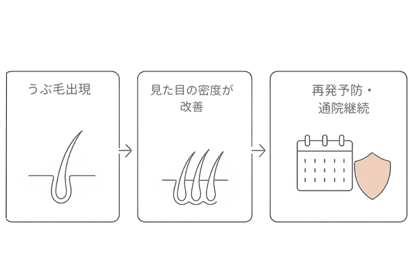 円形脱毛症の回復タイムライン(1~12か月)|うぶ毛出現から見た目改善・再発予防まで