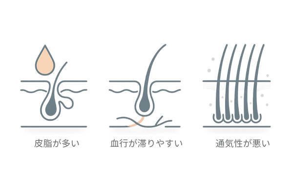 頭皮の特徴を示す3つのポイント｜スカルプケア入門