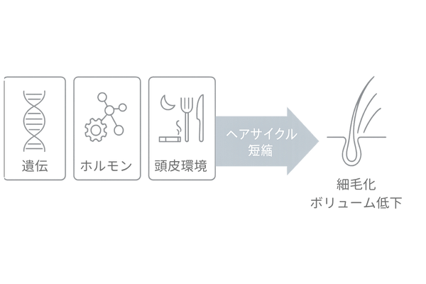 若ハゲの主因フロー図解(20代・AGA/遺伝・ホルモン・生活習慣・頭皮環境)