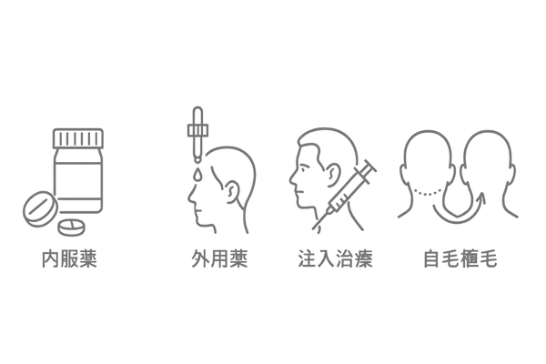AGA治療の選択肢比較|内服薬・外用薬・注入治療・自毛植毛アイコン