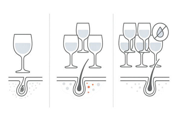 飲酒量の違いと頭皮環境・抜け毛リスクの比較（適量・過量・暴飲）