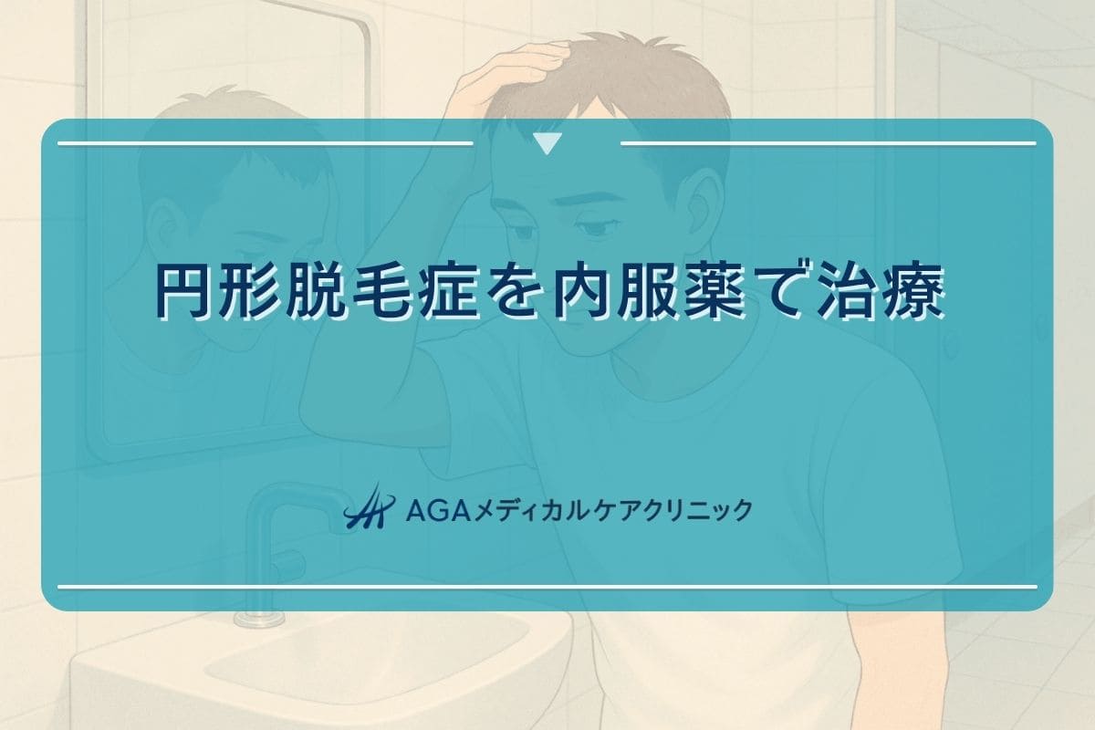 円形脱毛症 内服薬、円形脱毛症 飲み薬、円形脱毛症 飲み薬 副作用