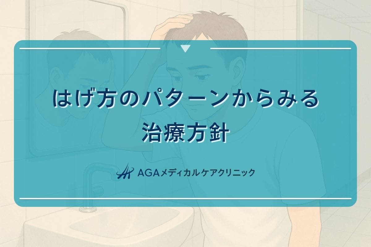 はげ方 パターン, はげ方 種類