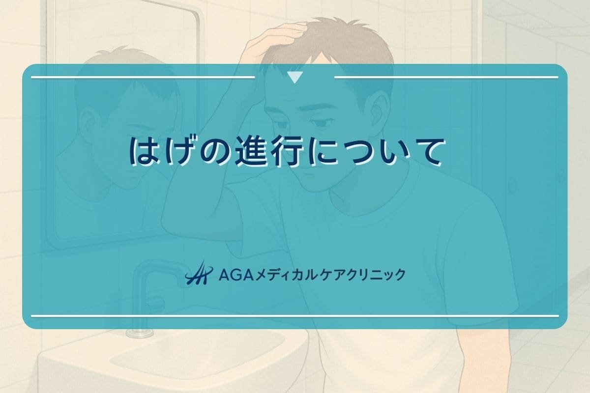 はげ　進行