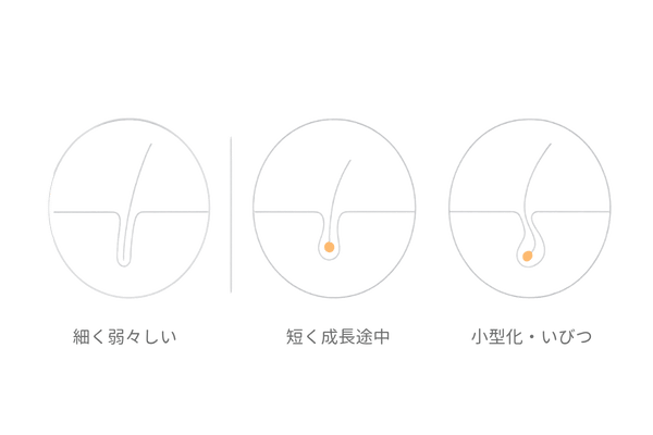 抜け毛セルフチェック図解｜毛の太さ・長さ・毛根でわかるはげの兆候