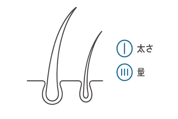 太い正常毛と細い乏毛の比較図