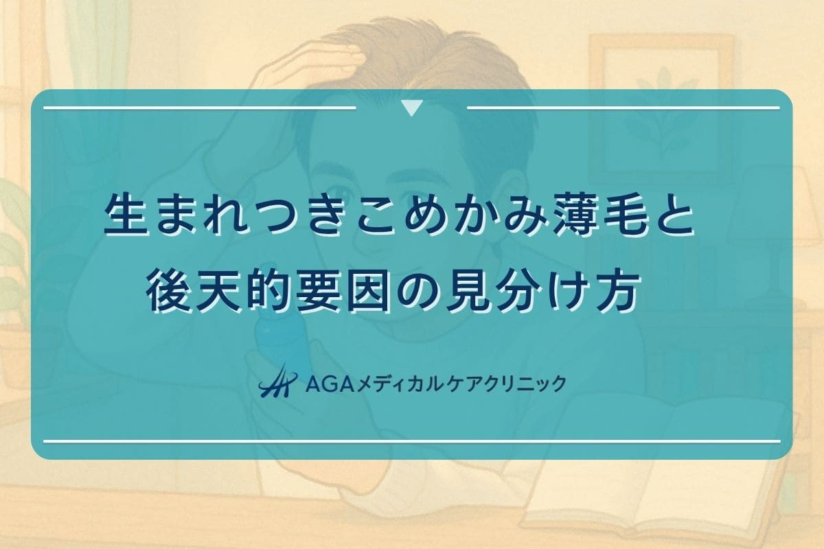 こめかみ 薄い 生まれつき, こめかみ 髪 ない 男