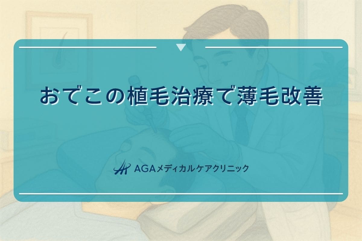おでこ 植毛