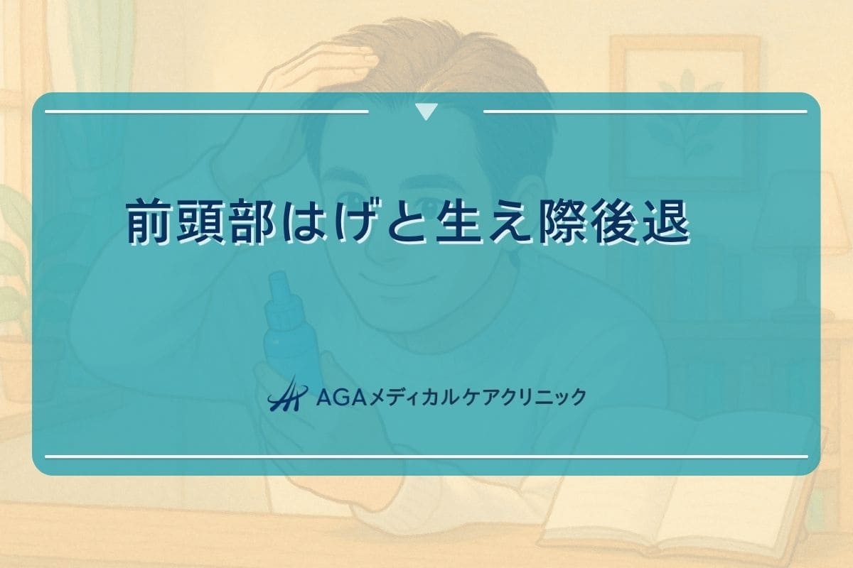 はげ おでこ, はげ 生え際, はげ 後退
