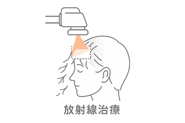 放射線治療による脱毛