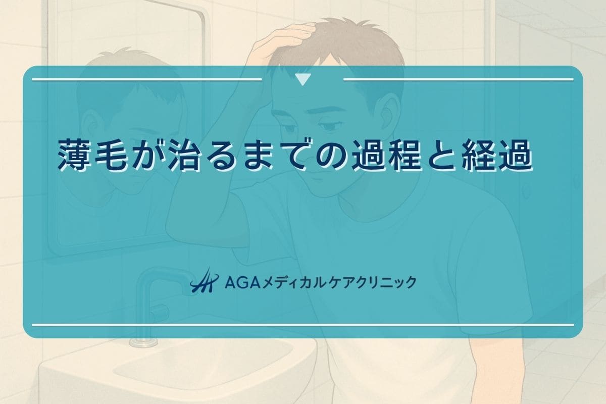 薄毛が治った, 薄毛 治る 前兆