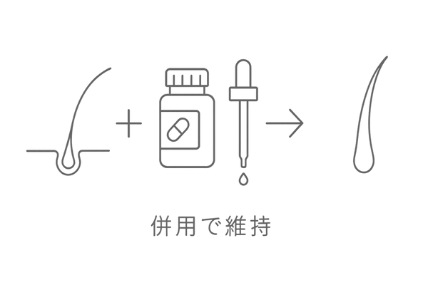 植毛と内服薬の相乗効果を示すシンプルな構成図