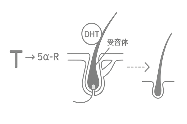 DHTと生え際薄毛のメカニズム図解|5αリダクターゼの作用