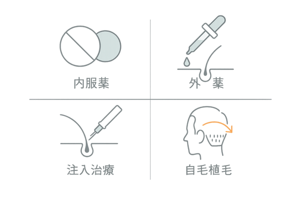 生え際薄毛の治療法比較|内服薬・外用薬・注入治療・自毛植毛