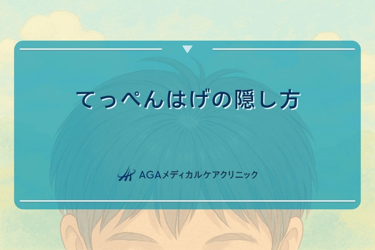 てっぺん はげ 隠し方, はげ 隠し方