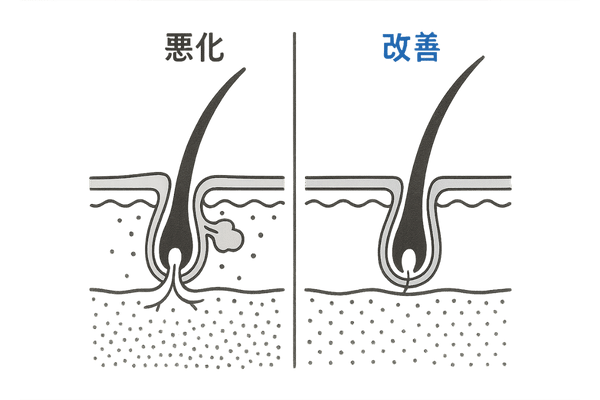 頭皮環境ビフォーアフター断面図