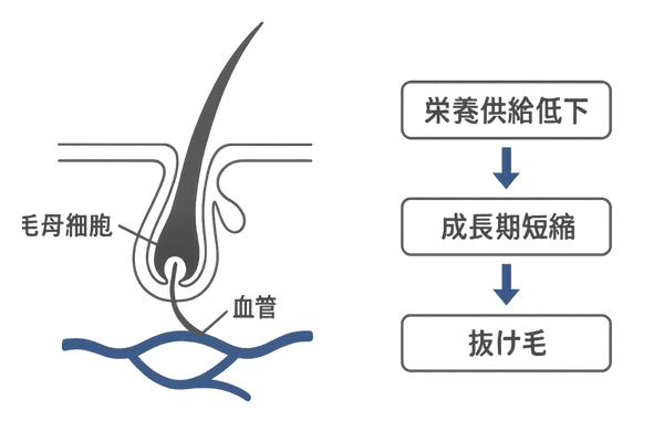 毛母細胞への栄養不足とヘアサイクル短縮を示すフロー図