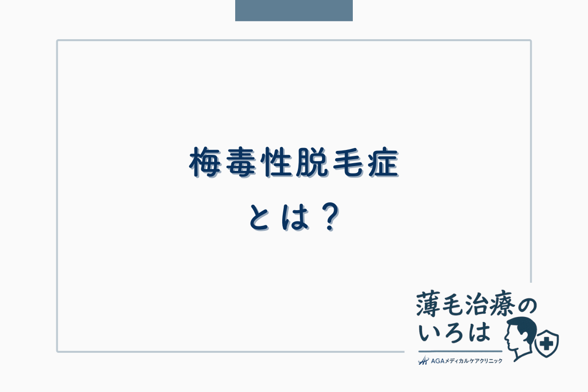 梅毒性脱毛症とは？