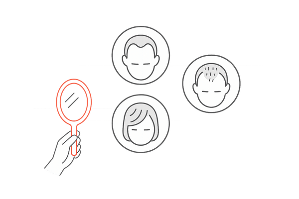 薄毛の症状とセルフチェック~早期発見が鍵~