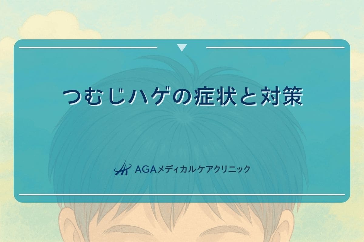 つむじ はげ, aga つむじ