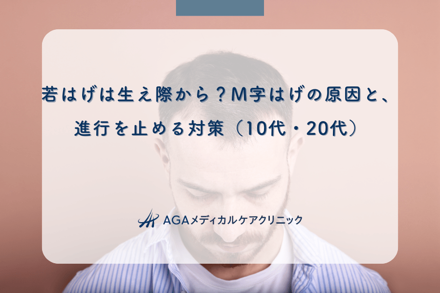 若はげは生え際から?M字はげの原因と、進行を止める対策(10代・20代)