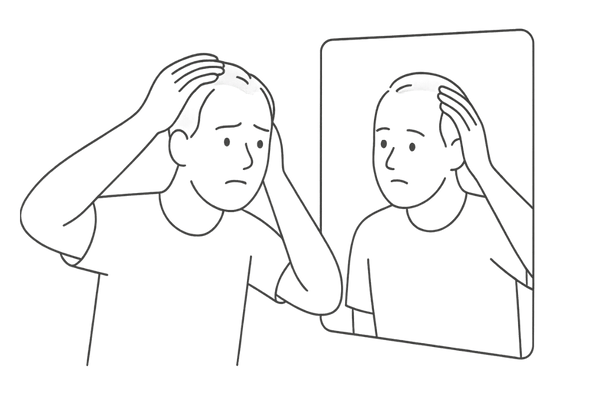 鏡の前で生え際を確認する不安げな男性のイラスト