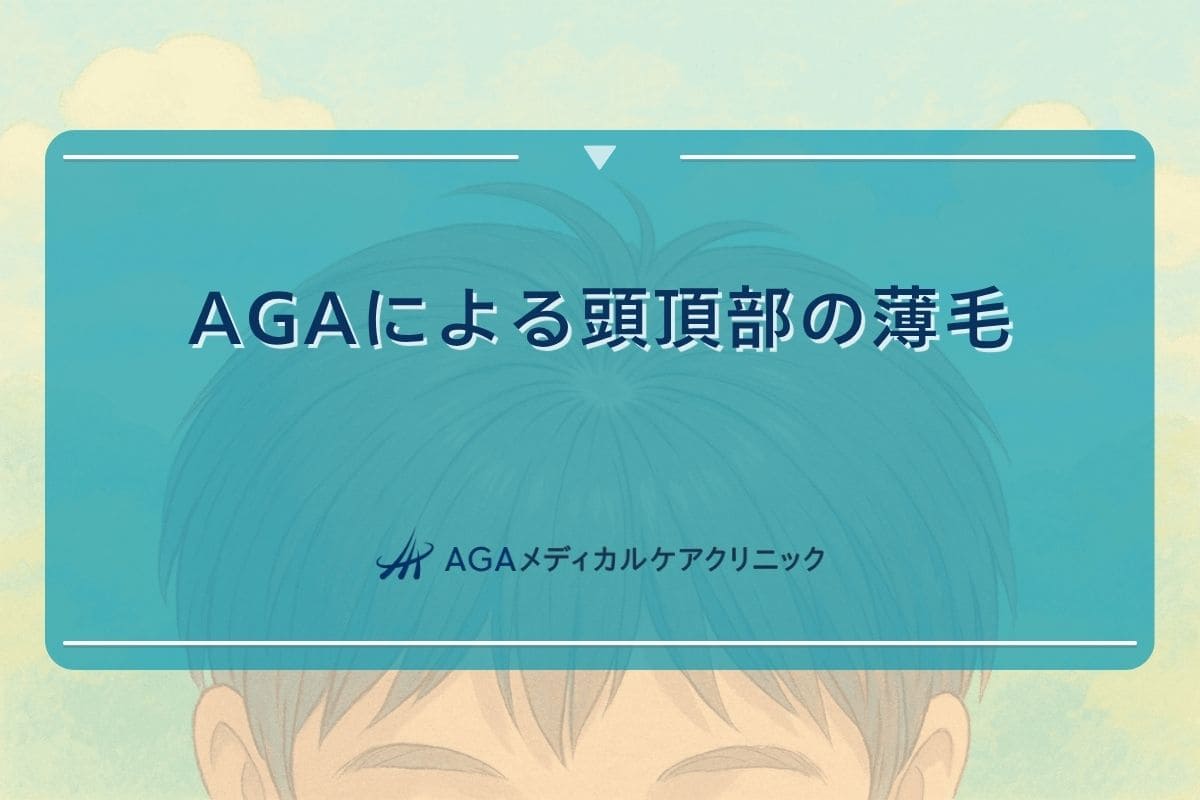 aga 頭頂部 薄毛
