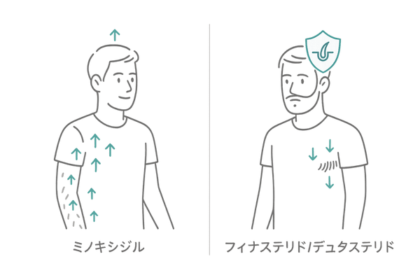 体毛の変化の比較図｜ミノキシジル内服の多毛傾向とフィナステリド・デュタステリドの体毛減少イメージ