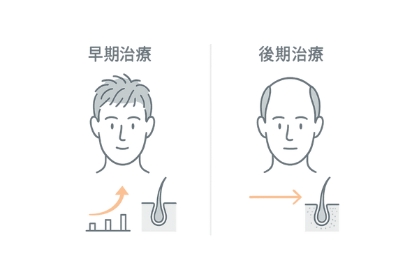 早期治療と後期治療の効果比較(AGAの進行抑制と改善度)
