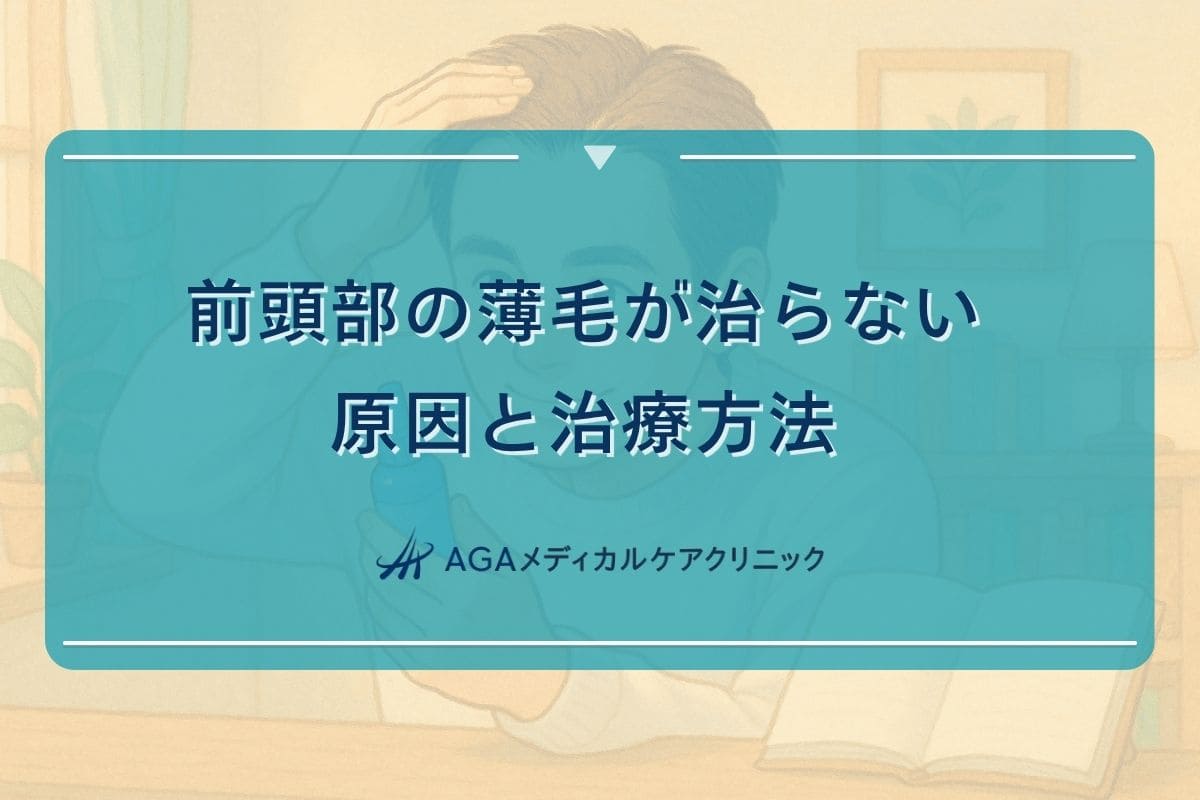 前頭部 薄毛 治らない、前頭部 薄毛 治る